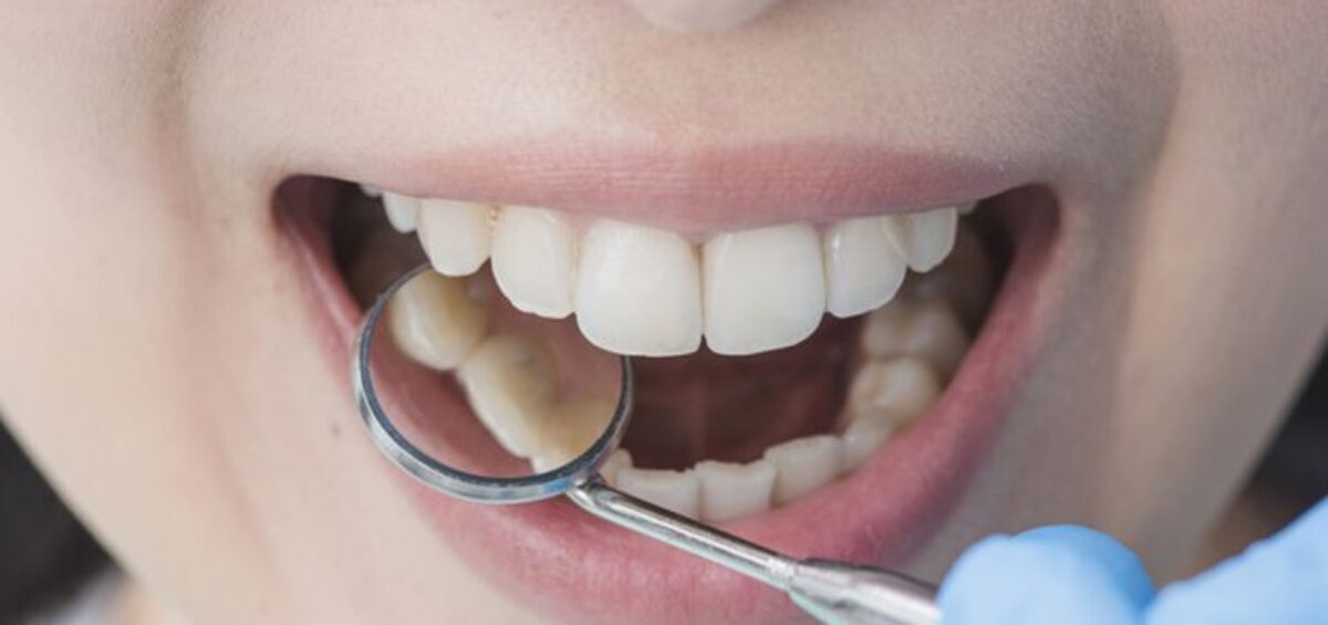 Your Pre-Dental Visit Checklist